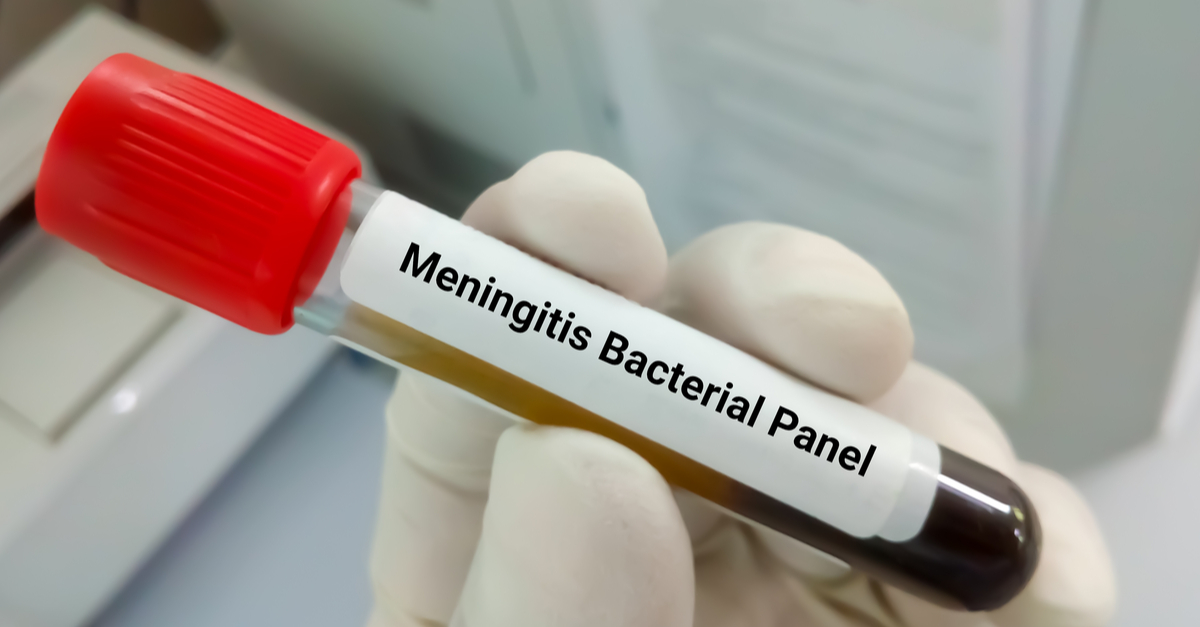 Delay in Diagnosing or Treating Bacterial Meningitis? | Medical Malpractice Lawyer Directory