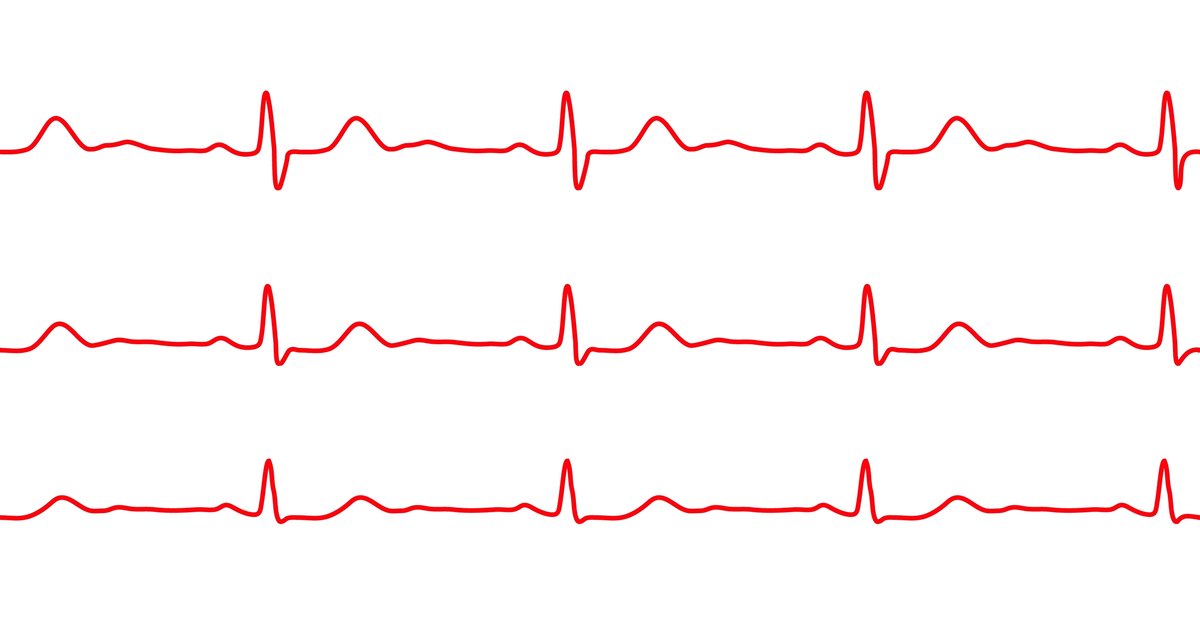 Heart Attack Misdiagnosis Medical Malpractice Attorney Directory